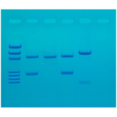 DNA Fingerprinting by PCR Amplification-image