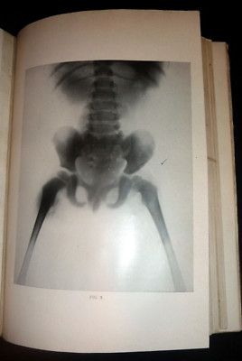 1907 Annals of Gynecology & Pediatry, Scarce Medical Journal, Roentgen Plates-image